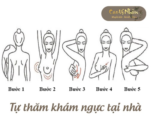 Tự thăm khám vú tại nhà định kỳ là việc vô cùng cần thiết