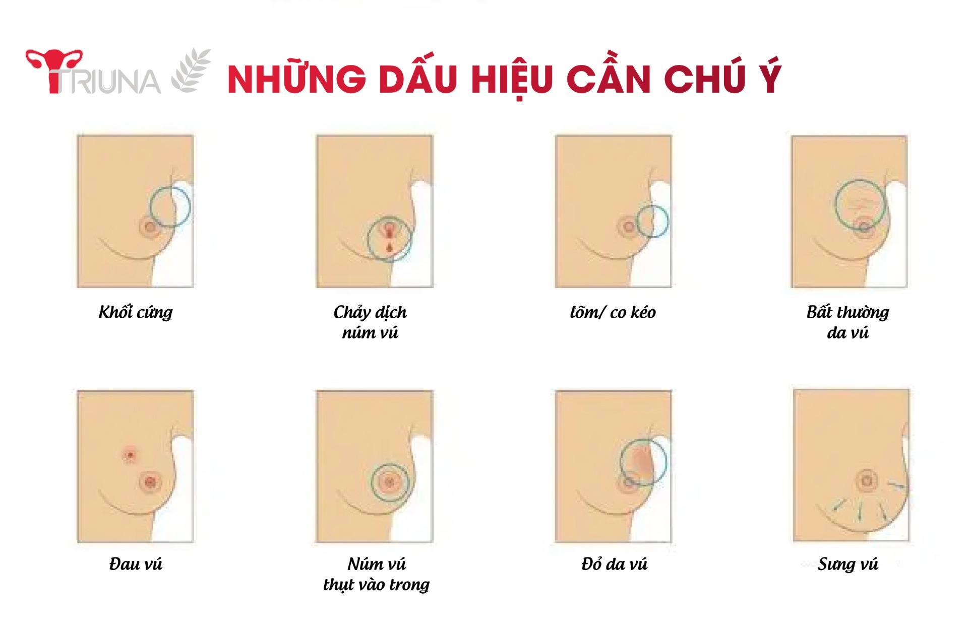 Một số dấu hiệu bất thường hay gặp