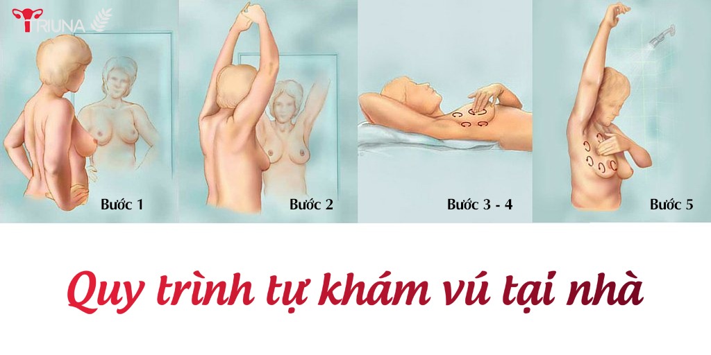 Tự khám vú tại nhà với 5 bước đơn giản